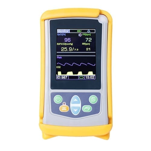 CO2 Anesthesia Monitoring in Toronto, Ontario